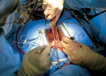 В Согдийской области проведены две уникальные операции на сердце