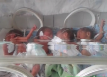 Минздрав: Четверня новорожденных, появившаяся на свет в Душанбе, не выжила