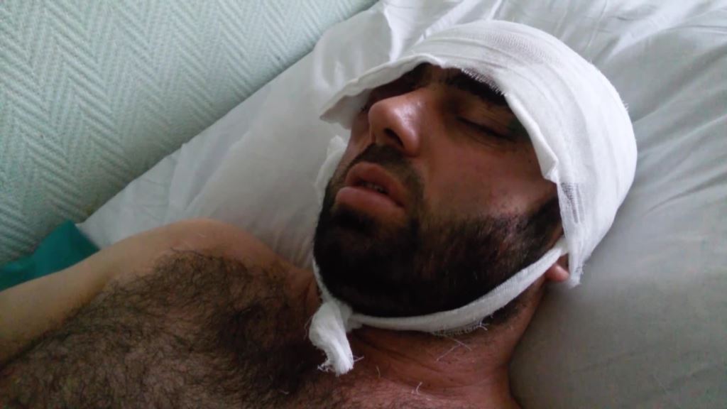 Сулаймону Саидову, жертве нападения в Московском метро удалили глаз