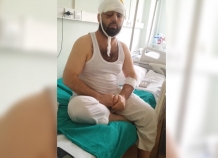 Жертве нападения в метро Сулаймону Саидову удалят правый глаз