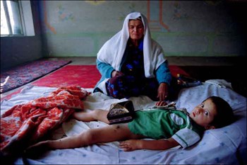 В Таджикистане разработан порядок обрезания мальчиков в медучреждениях