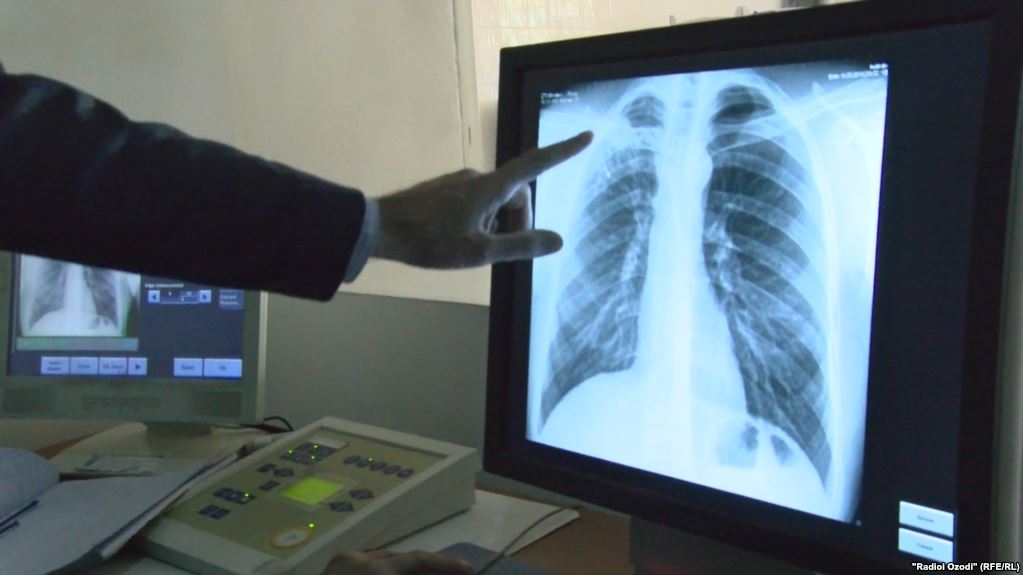 МАГАТЭ передало Таджикистану оборудование для лечения онкобольных